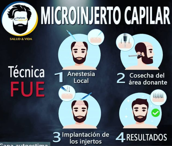 isntagram Salud & Vida - Injerto Capilar